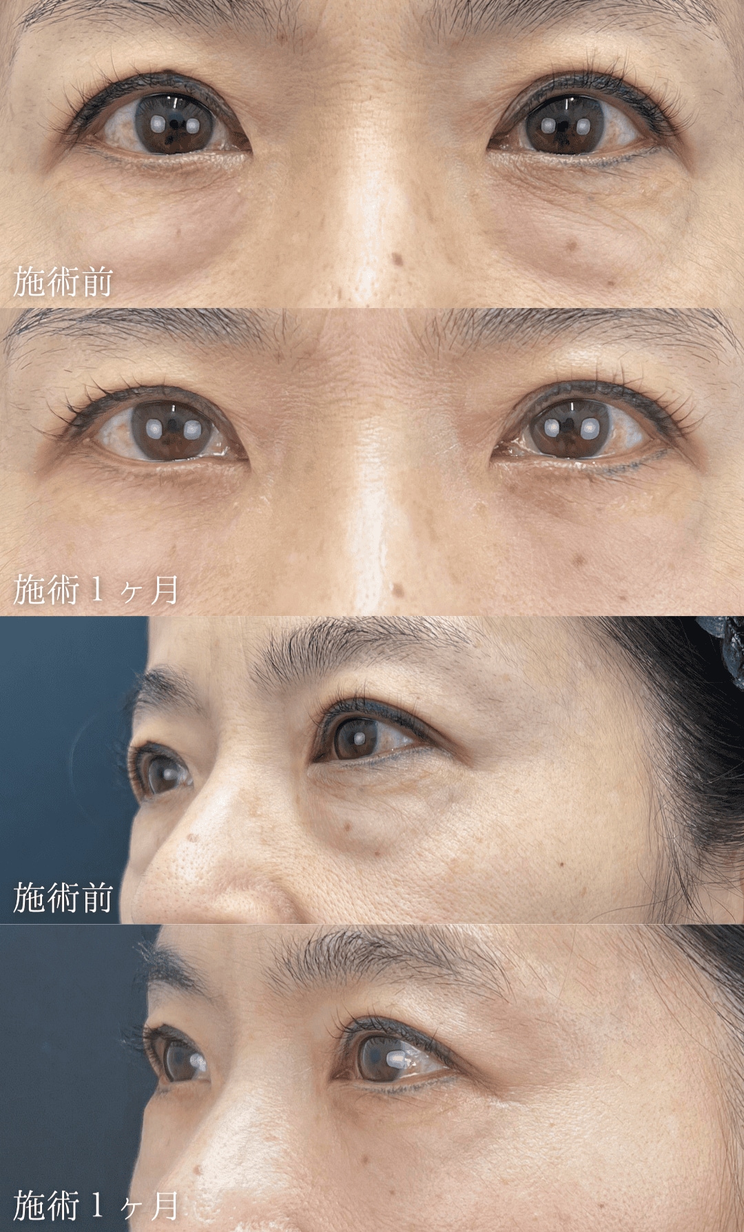 50代女性「目元の「老け見え」、まとめてリセットしたい」